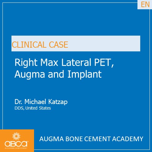 Right Max Lateral PET, Augma and Implant