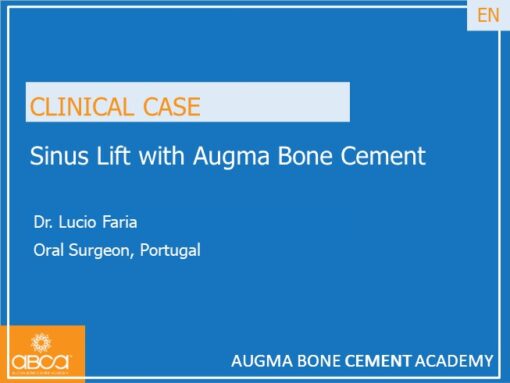 Sinus Lift with Augma Bone Cement
