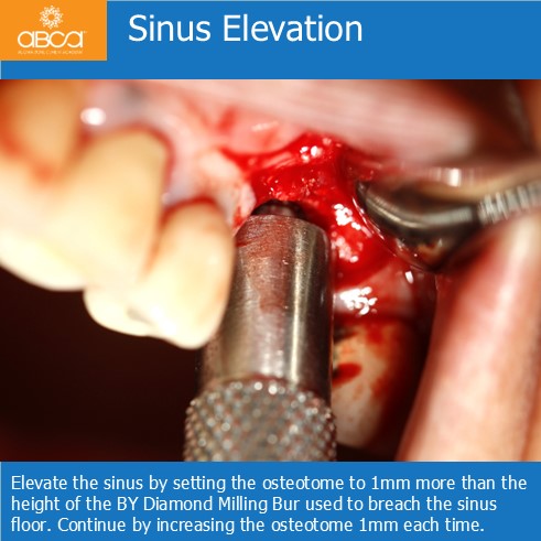 Clinical Case