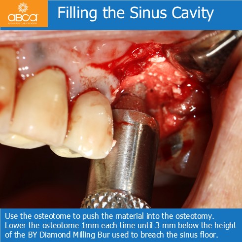 Clinical Case