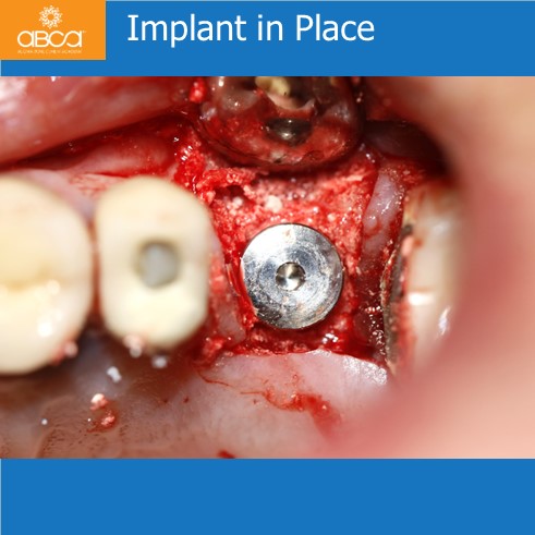 Clinical Case