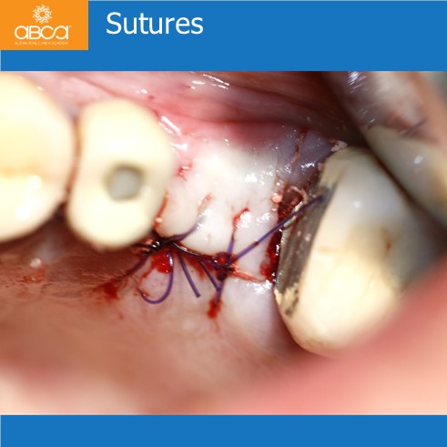 Clinical Case