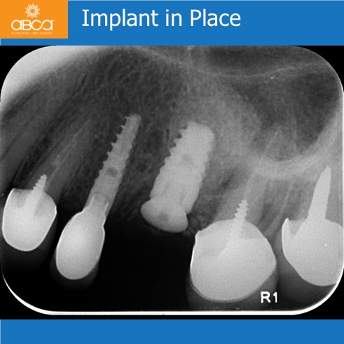 Clinical Case