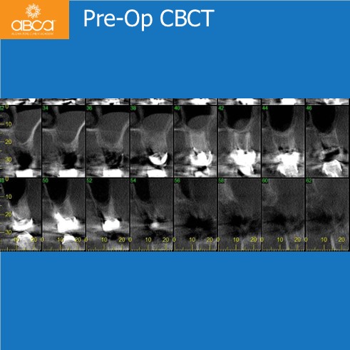 Clinical Case