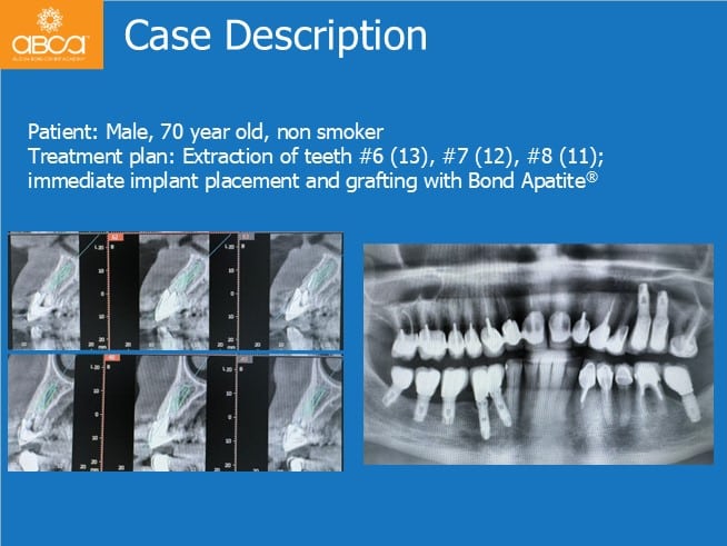 Clinical Case