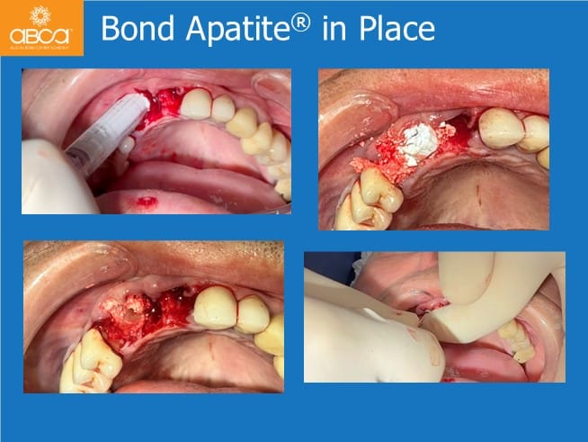 Clinical Case