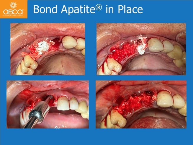 Clinical Case