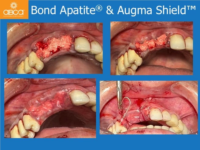 Clinical Case