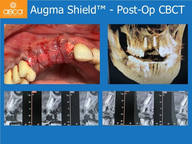 Clinical Case