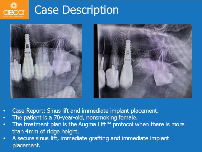 Clinical Case