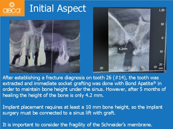 Clinical Case