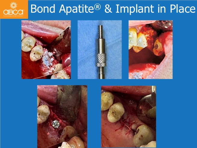 Clinical Case