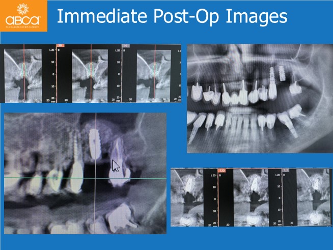 Clinical Case