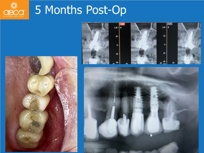 Clinical Case