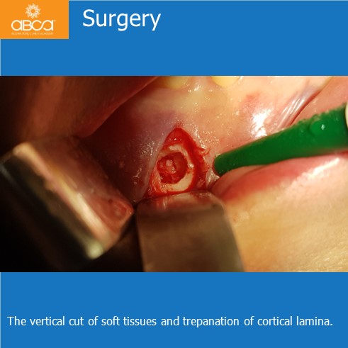 Clinical Case