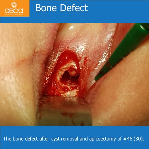 Clinical Case