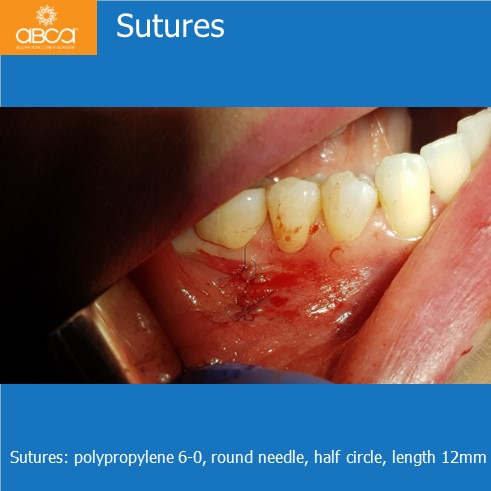 Clinical Case