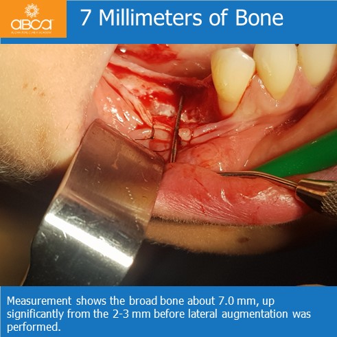 Clinical Case