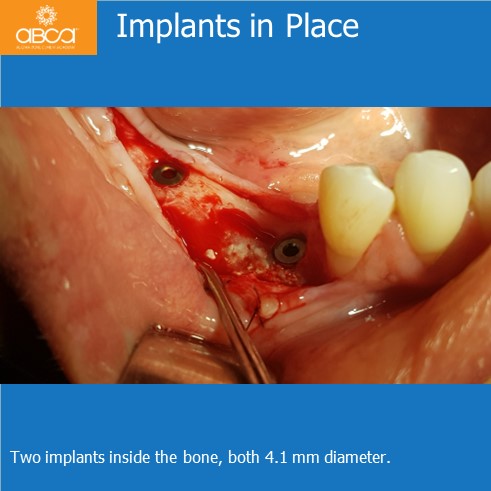 Clinical Case