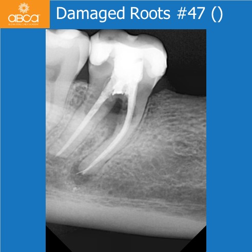 Clinical Case