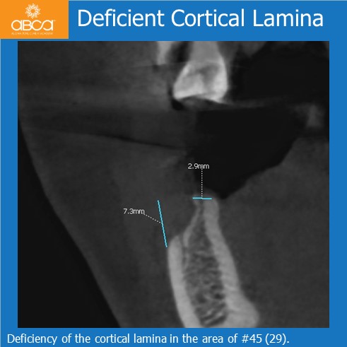 Clinical Case