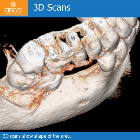 Clinical Case