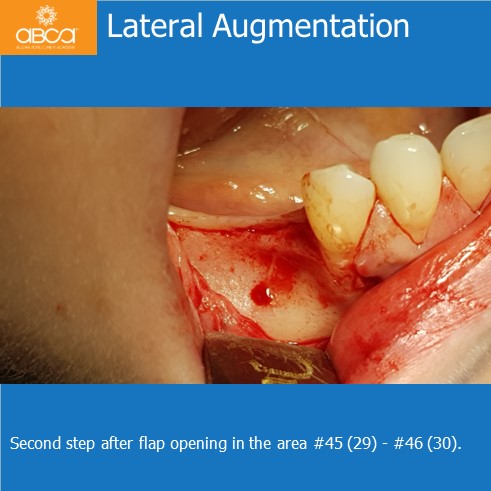 Clinical Case