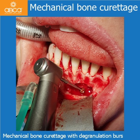 Clinical Case