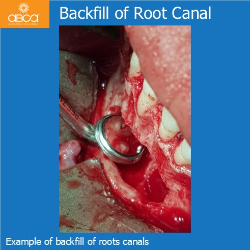 Clinical Case