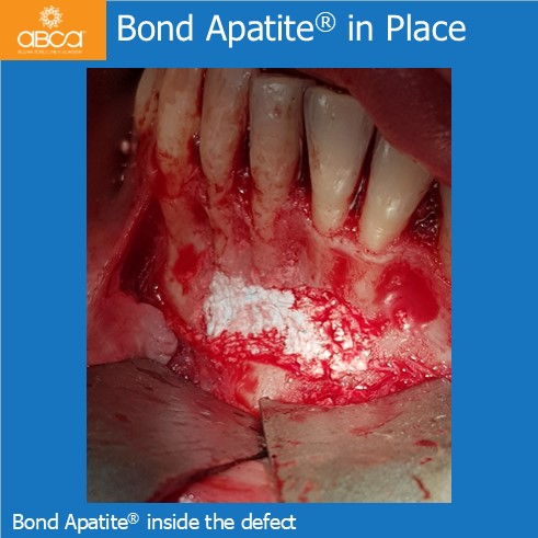 Clinical Case