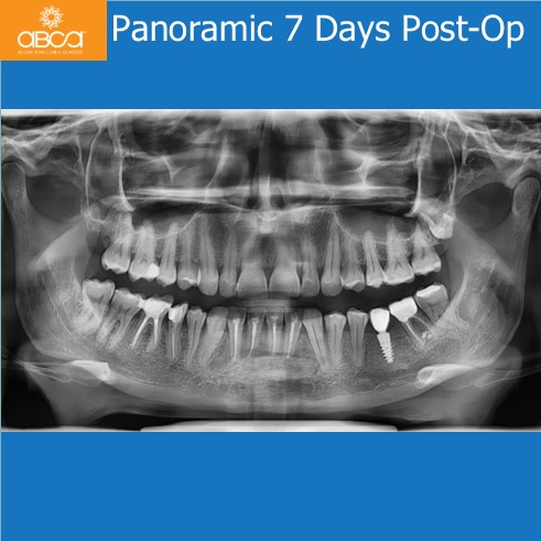 Clinical Case