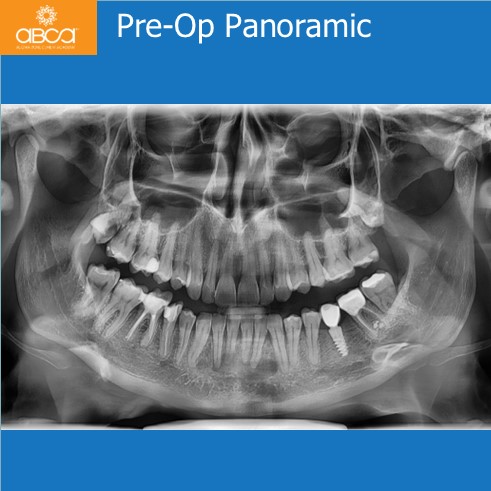 Clinical Case