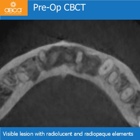 Clinical Case