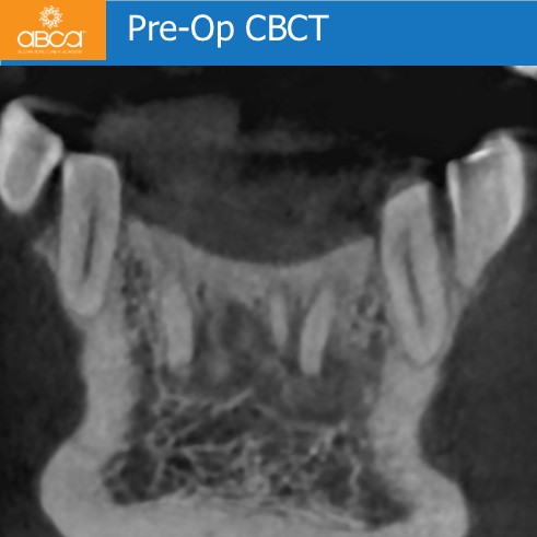 Clinical Case