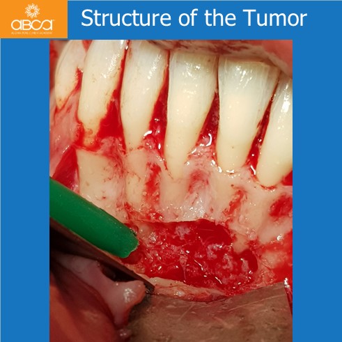 Clinical Case