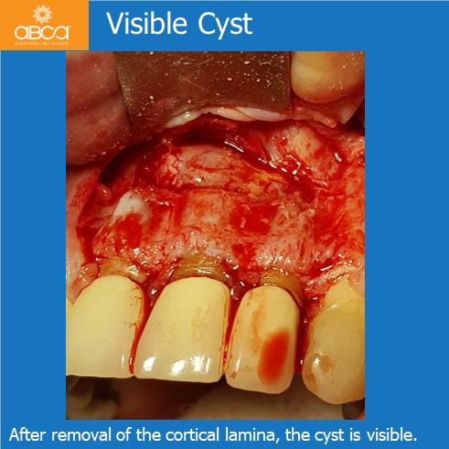 Clinical Case