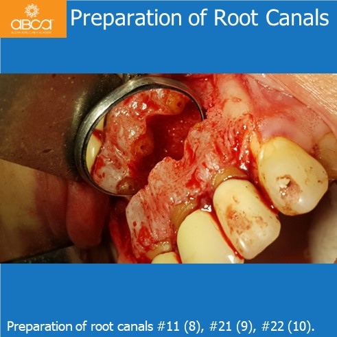 Clinical Case