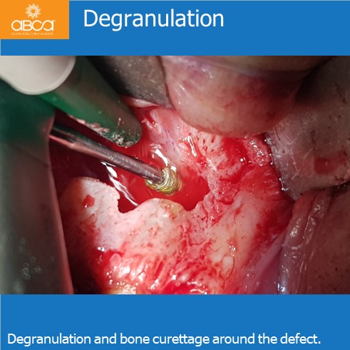 Clinical Case