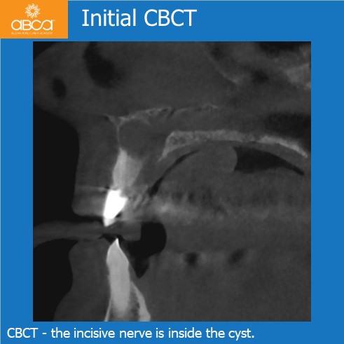 Clinical Case