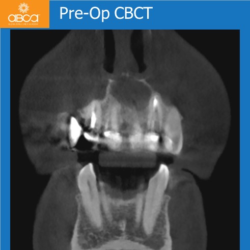 Clinical Case