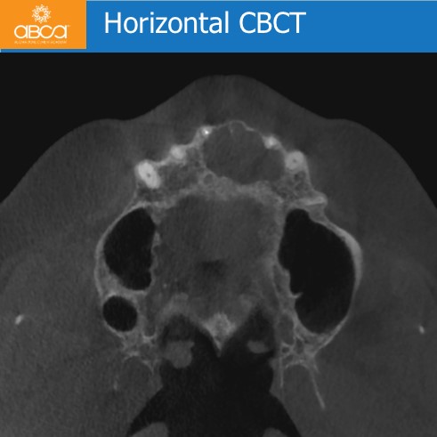 Clinical Case