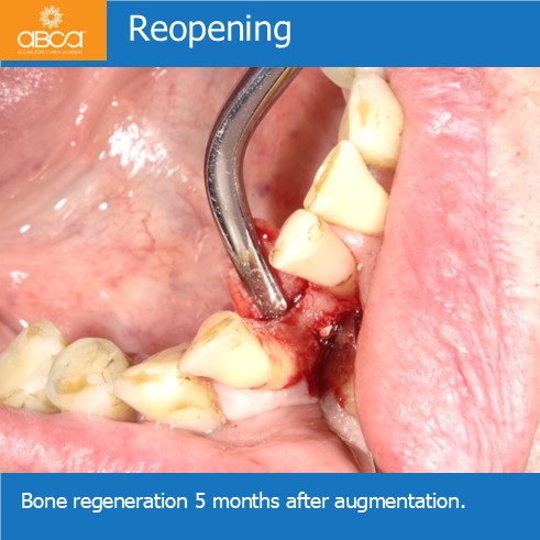 Clinical Case