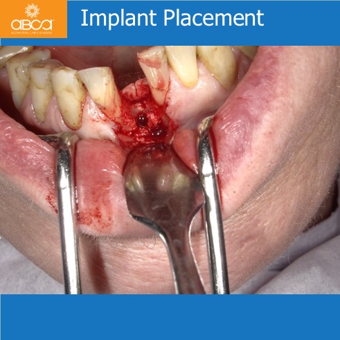 Clinical Case