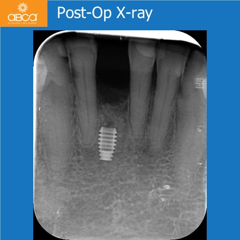 Clinical Case