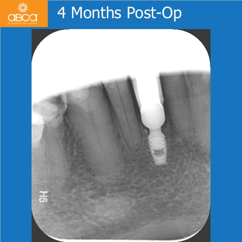 Clinical Case