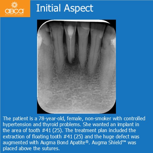 Clinical Case