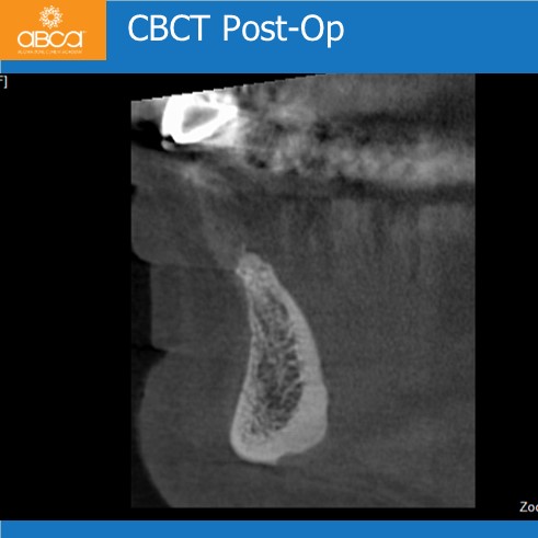 Clinical Case