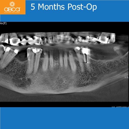 Clinical Case