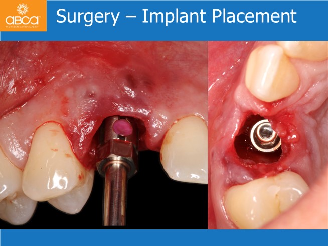 Clinical Case