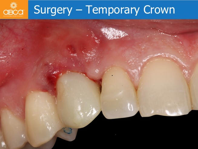 Clinical Case